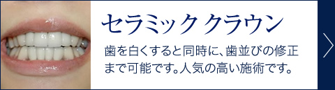 セラミッククラウン