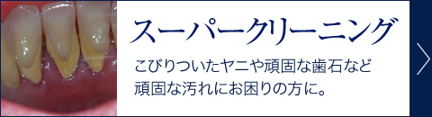 歯のスーパークリーニング