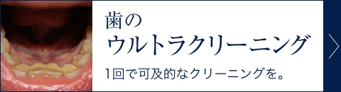 歯のウルトラクリーニング
