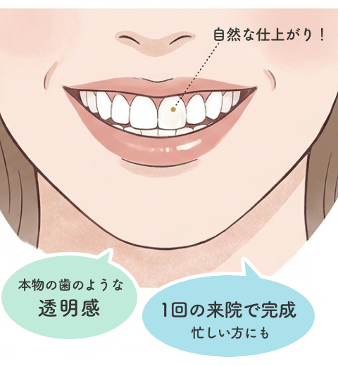 1回の来院で完成