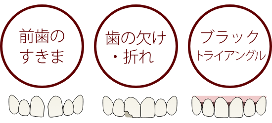 前歯のすきま、歯の欠け折れ、白い斑点