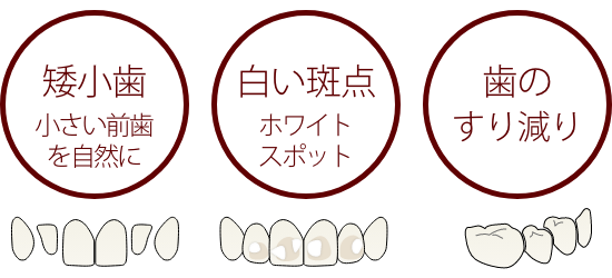 色や形がバラバラ、あまり削りたくない、歯のすり減り