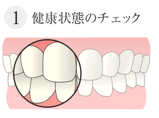 カウンセリング