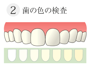 歯のいろの検査