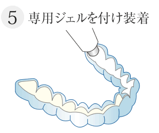 専用ジェルを付け装着